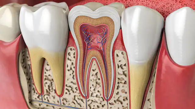 Endodontics Dentistry